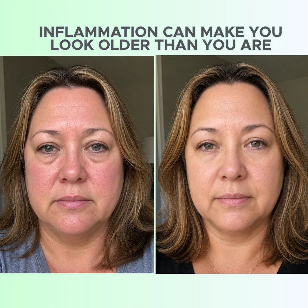 Anti-Aging Cryo Facial Recovery Kit - Firm & Lift Ice Facial for Inflammation-Affected Aging Skin