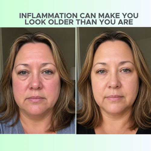 Anti-Aging Cryo Facial Recovery Kit - Firm & Lift Ice Facial for Inflammation-Affected Aging Skin